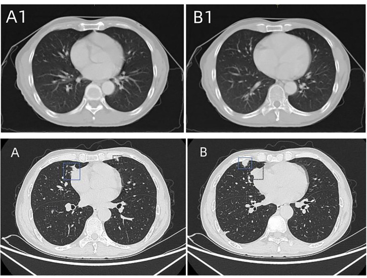 Figure 4