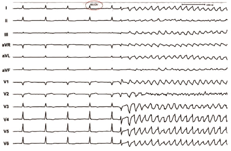 Figure 4: