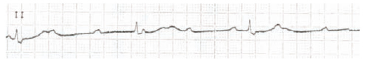 Fig. (7)