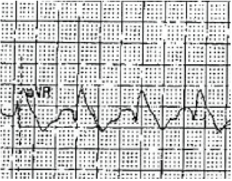 Fig. (8)