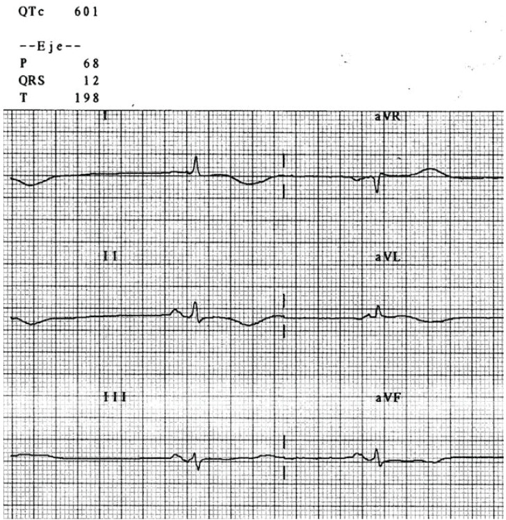 Fig. (12)