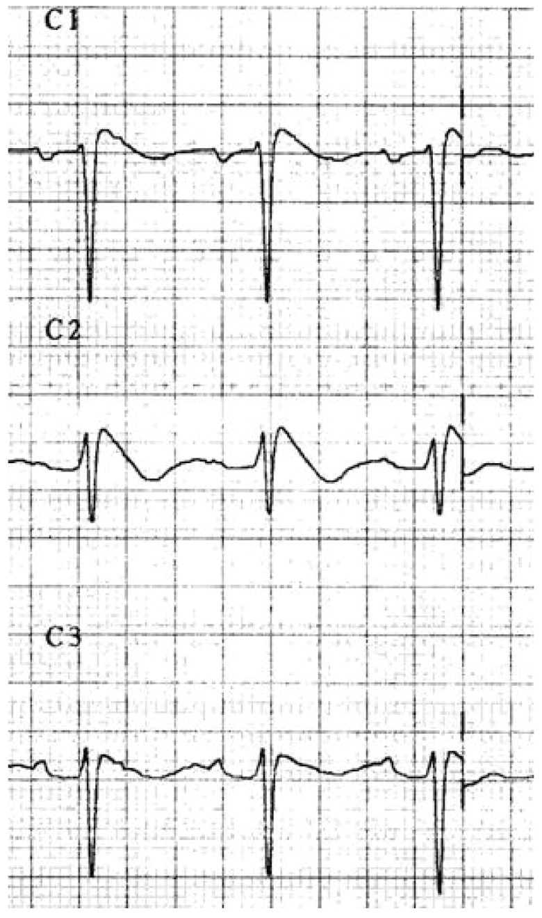 Fig. (9)