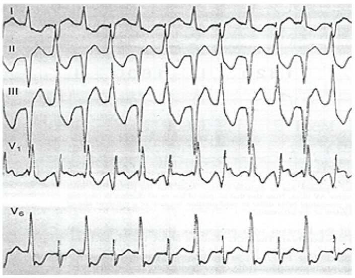 Fig. (20)