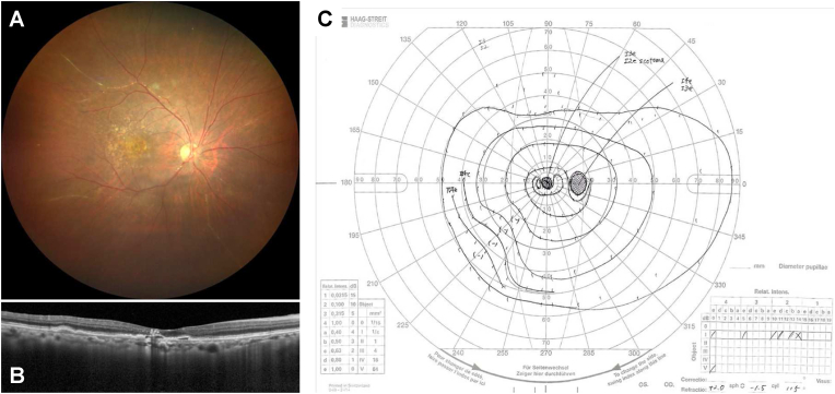 Fig. 4