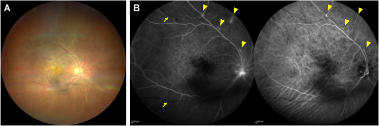 Fig. 2