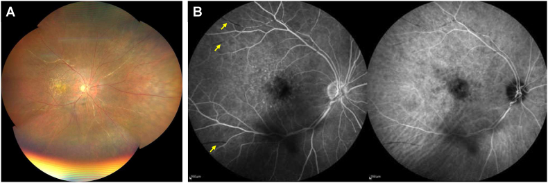 Fig. 3