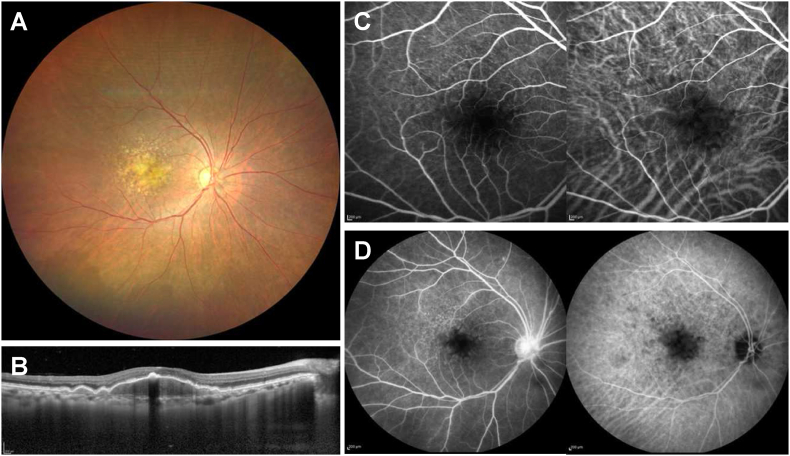 Fig. 1