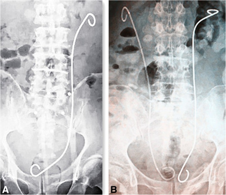 Fig. 1