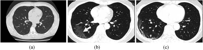 Fig. 2