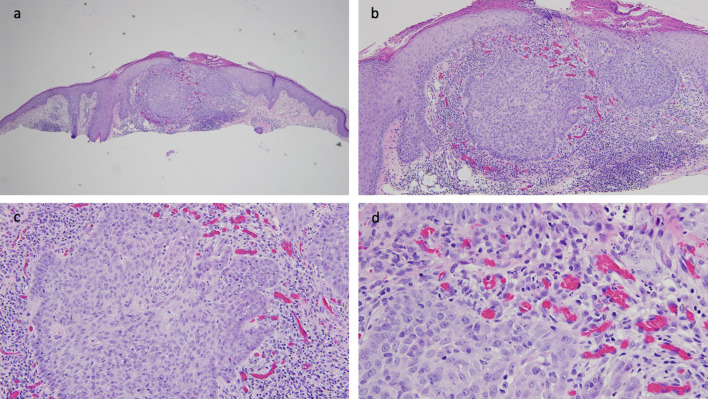 Fig. 2