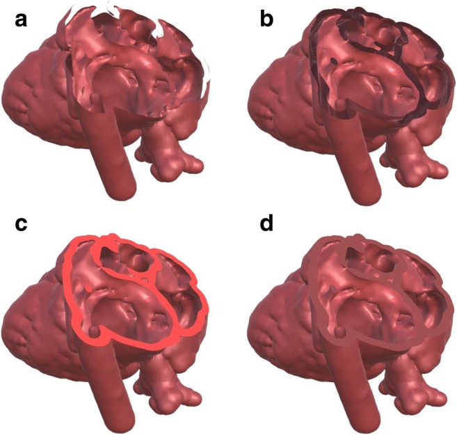 Fig. 10