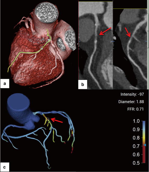 Fig. 4