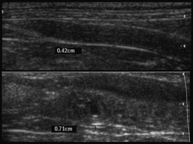 FIGURE 40-16