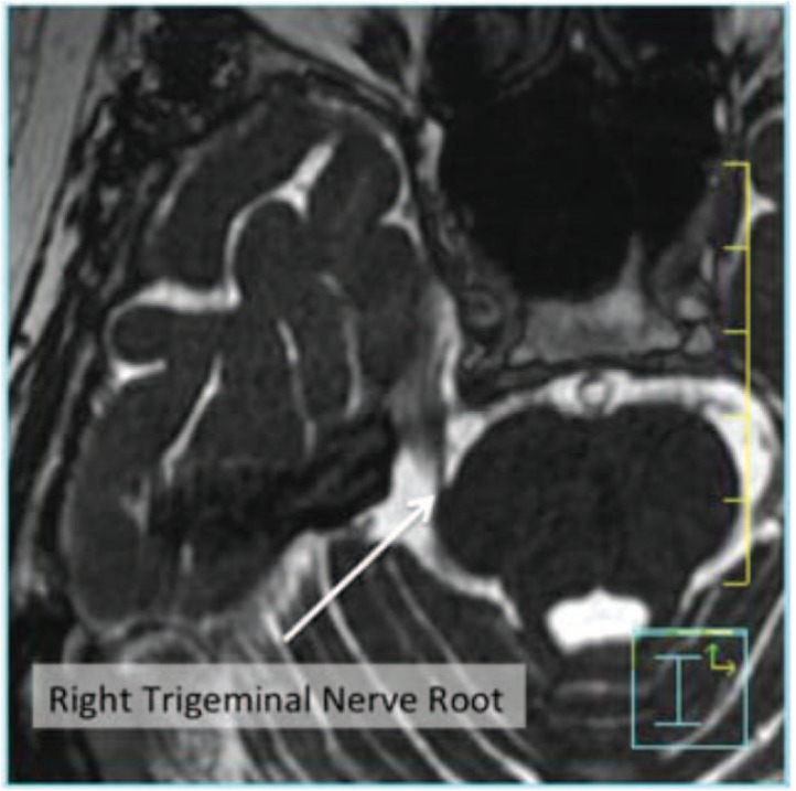 Figure 3: