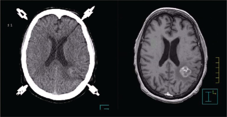 Figure 2: