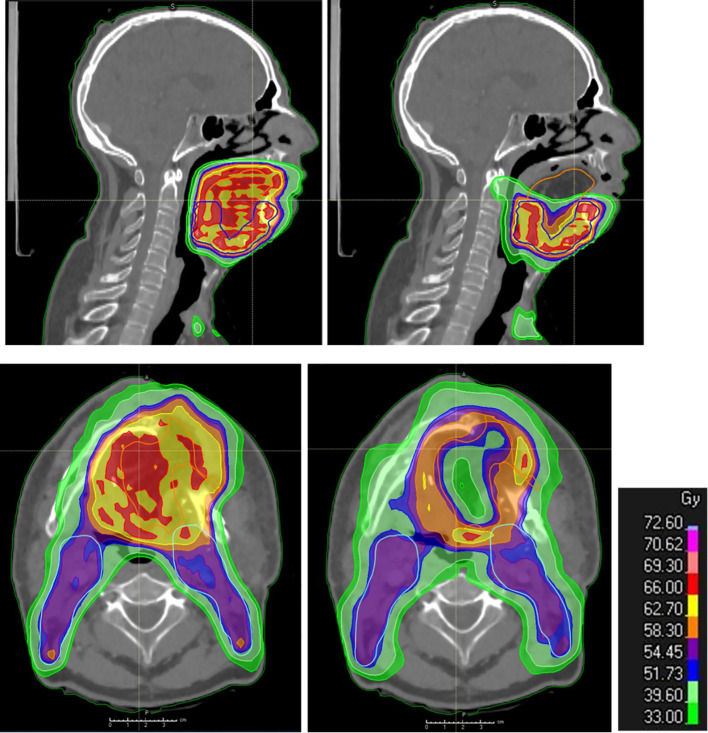 Figure 3