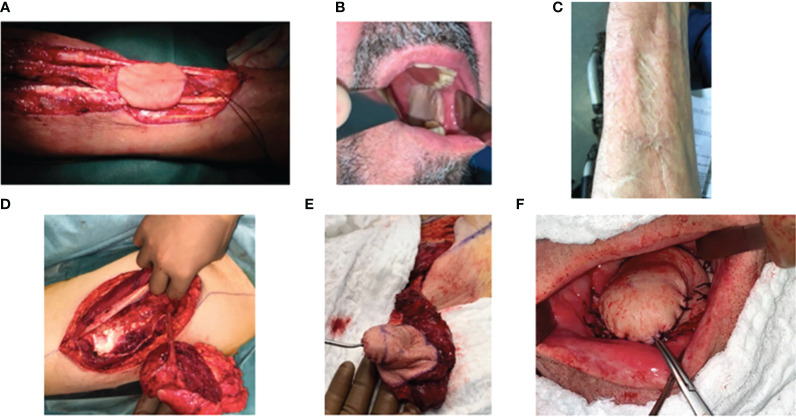 Figure 1