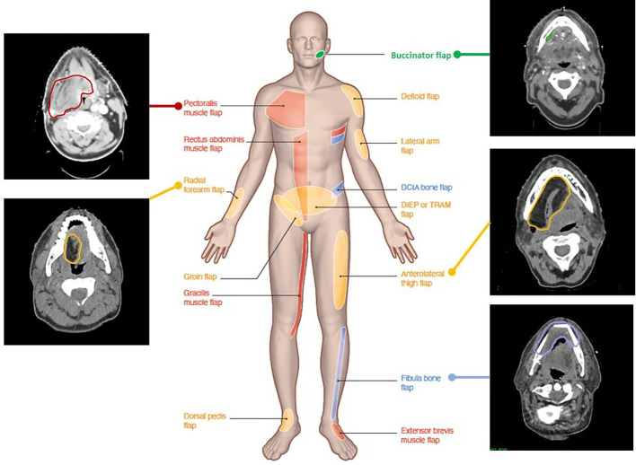 Figure 2