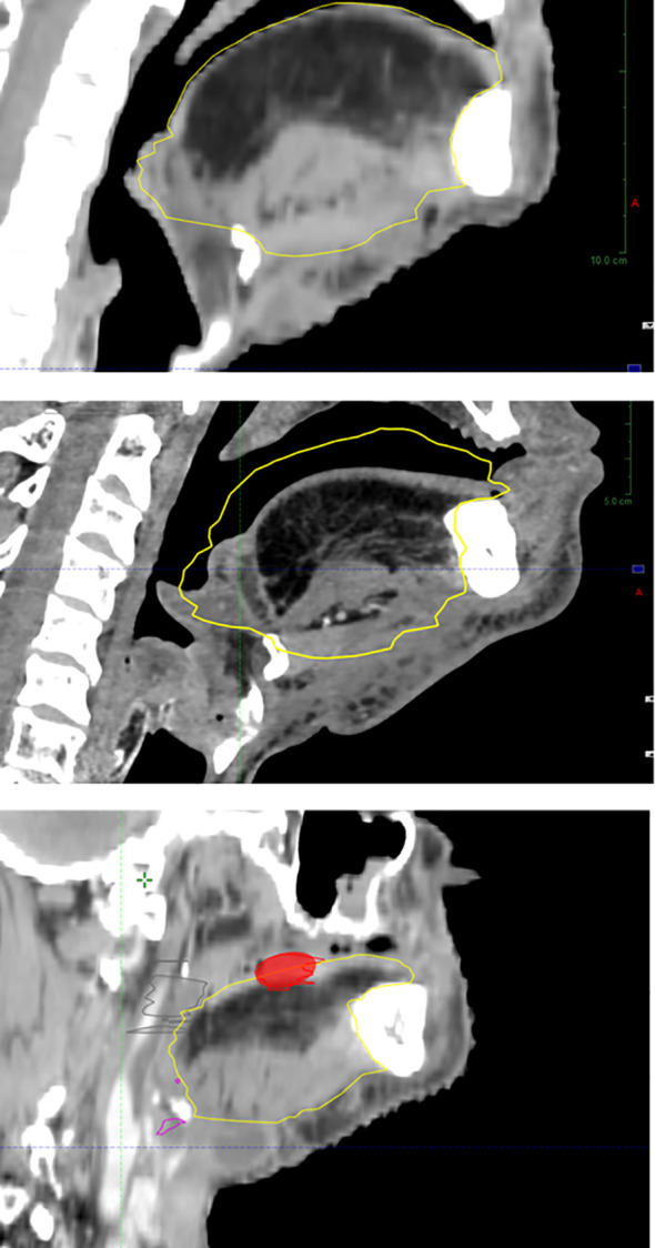 Figure 4