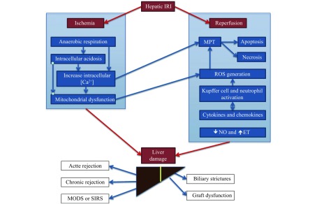 A simplified schematic detailing the individual effects of ischemia and reperfusion and their interaction to cause damage to the liver. MPT: mitochondrial permeability transition; ROS: reactive oxygen species; NO: nitrous oxide; ET: endothelin; MODS: multiple organ dysfunction syndrome; SIRS: systemic inflammatory response syndrome.