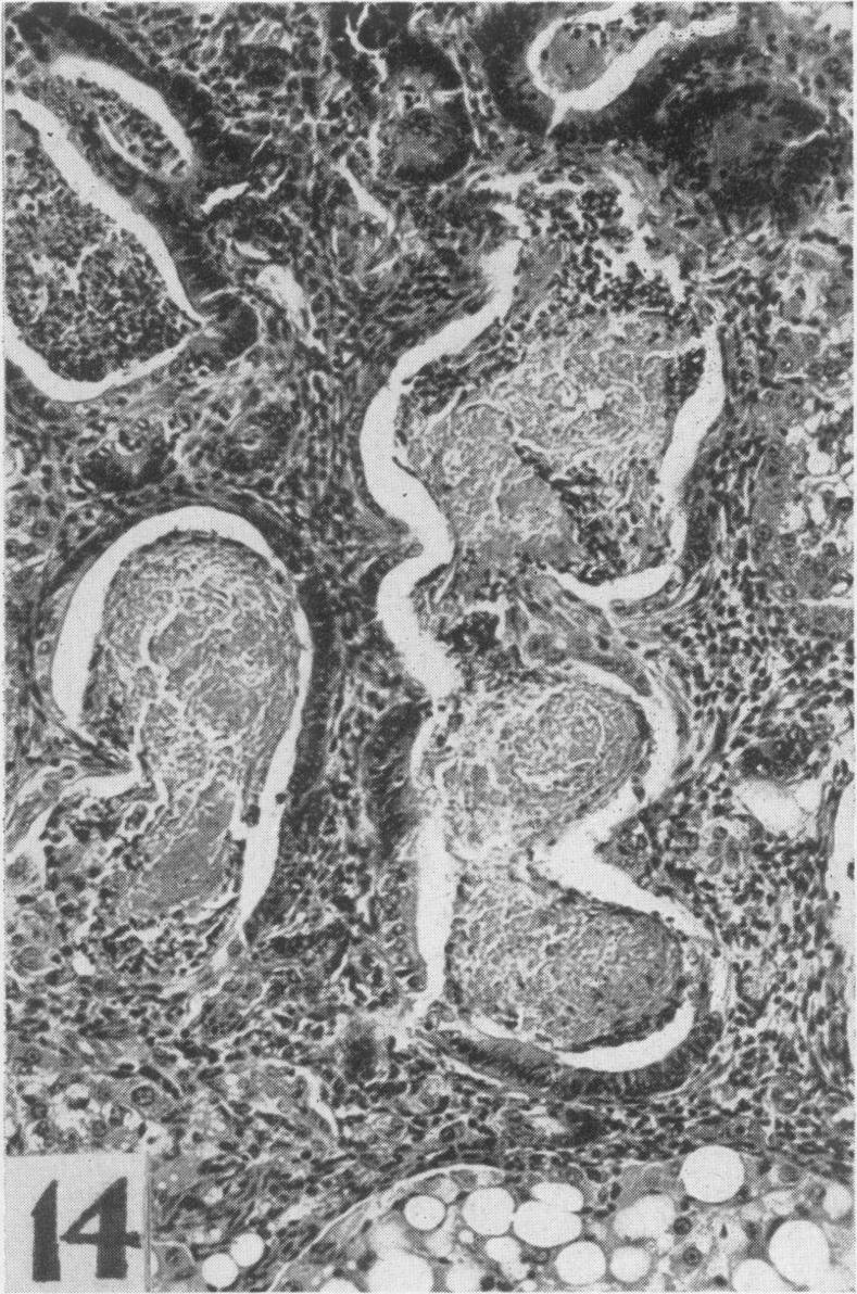 Fig. 14