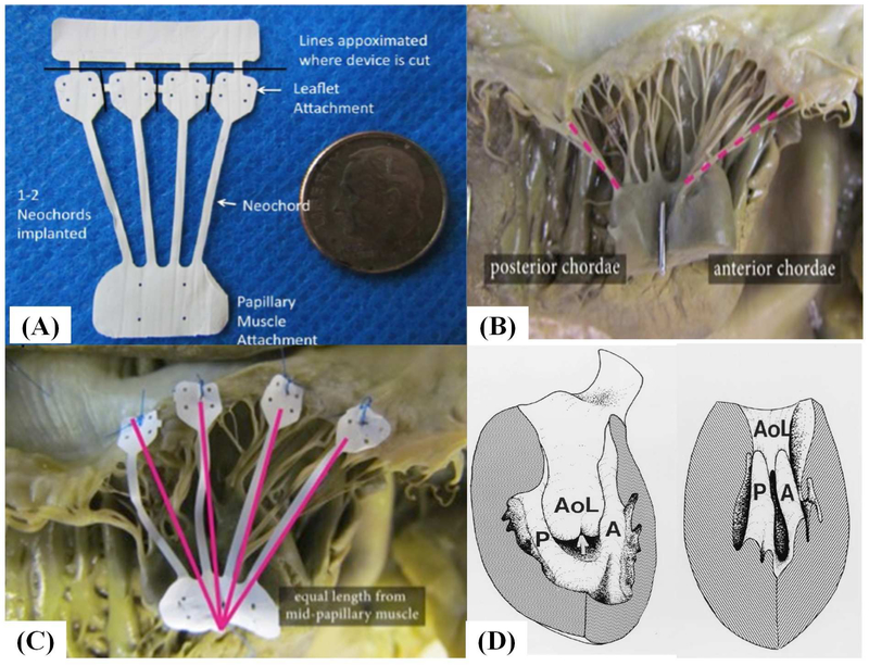 Figure 1: