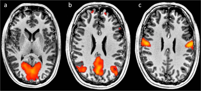 Fig. 9