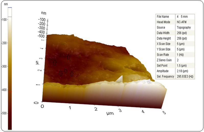 FIGURE 5