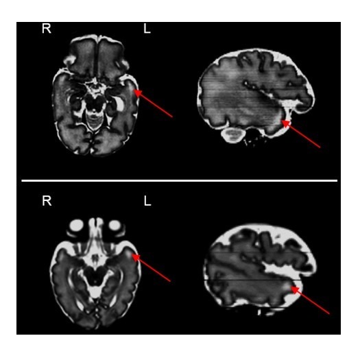 Figure 2—figure supplement 2.