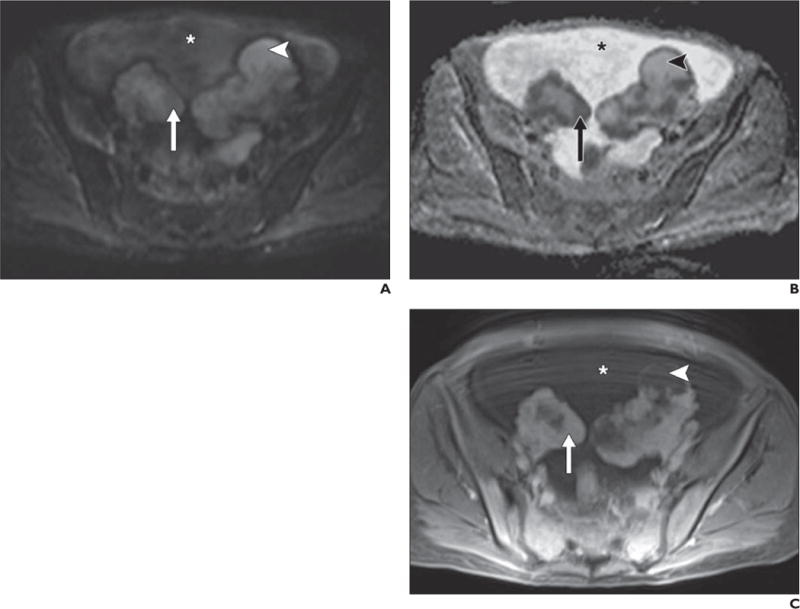 Fig. 12