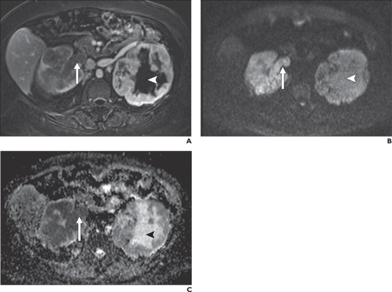 Fig. 13