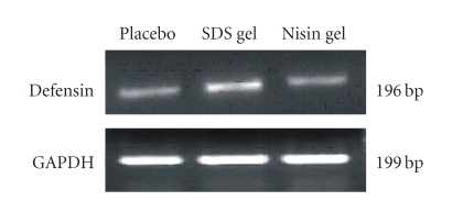 Figure 11