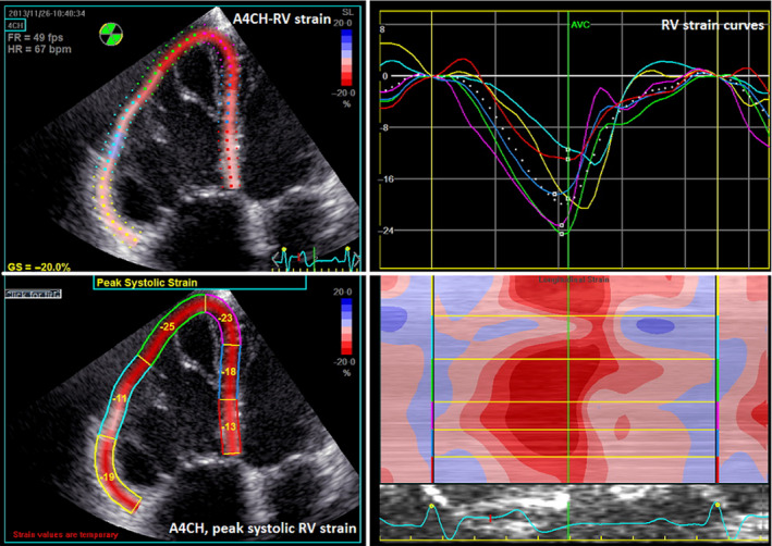 FIGURE 2