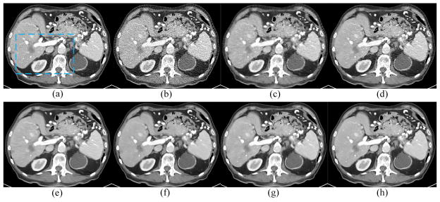 Fig. 10