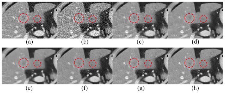 Fig. 13