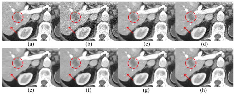 Fig. 11