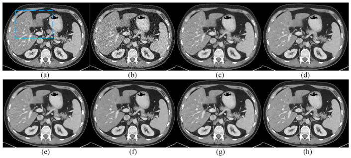 Fig. 12