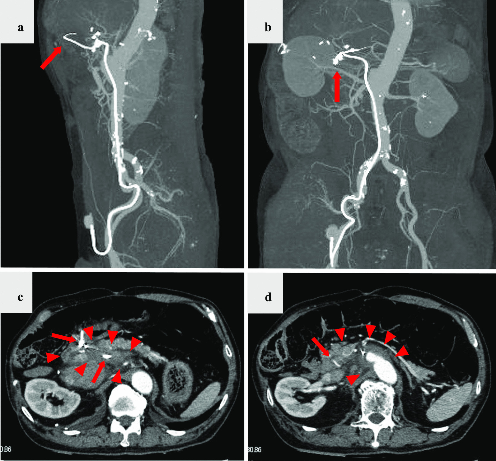 Fig. 1