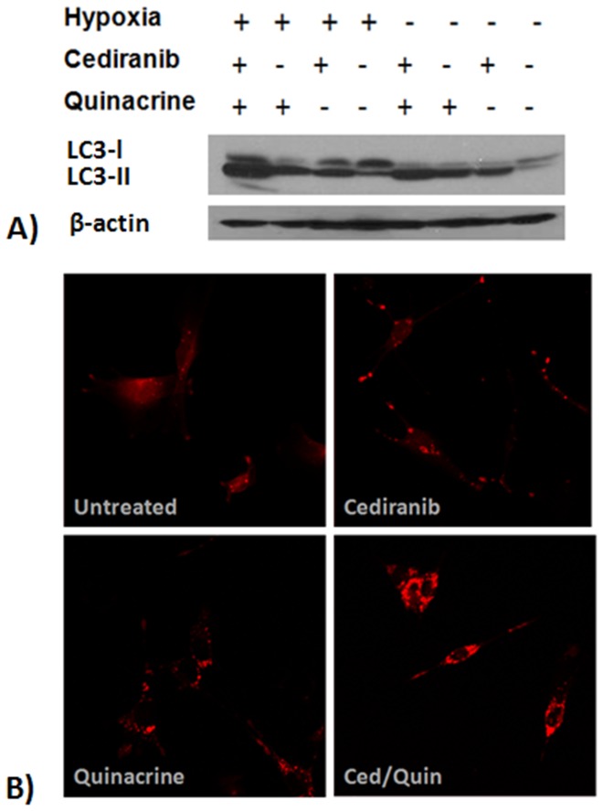 Combined Efficacy of Cediranib and Quinacrine in Glioma Is Enhanced by ...