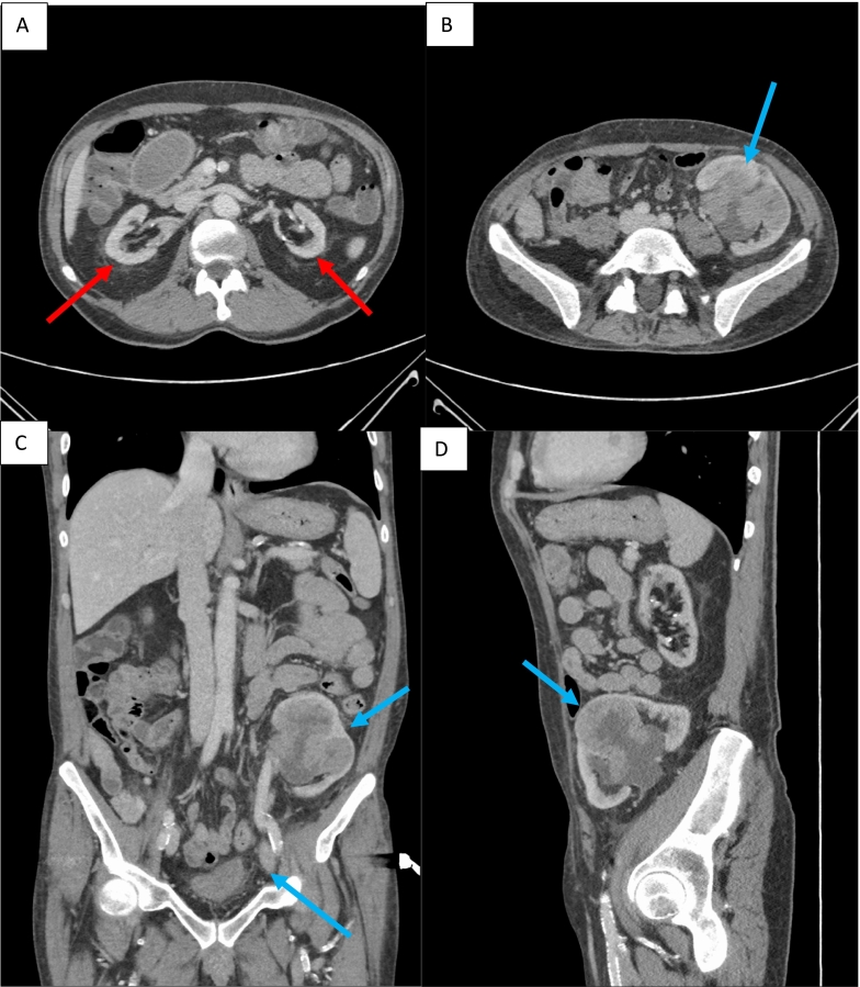 Fig. 1