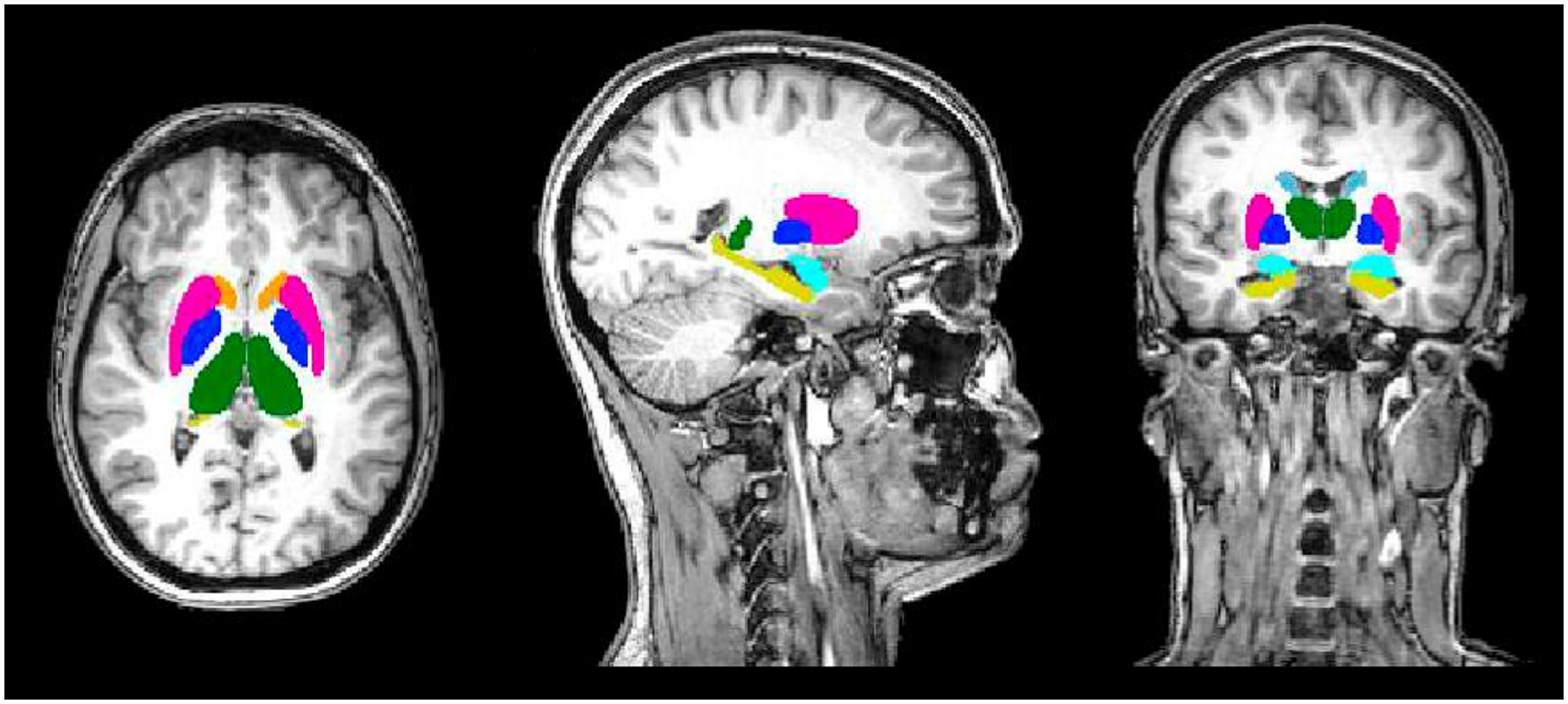 Fig. 1