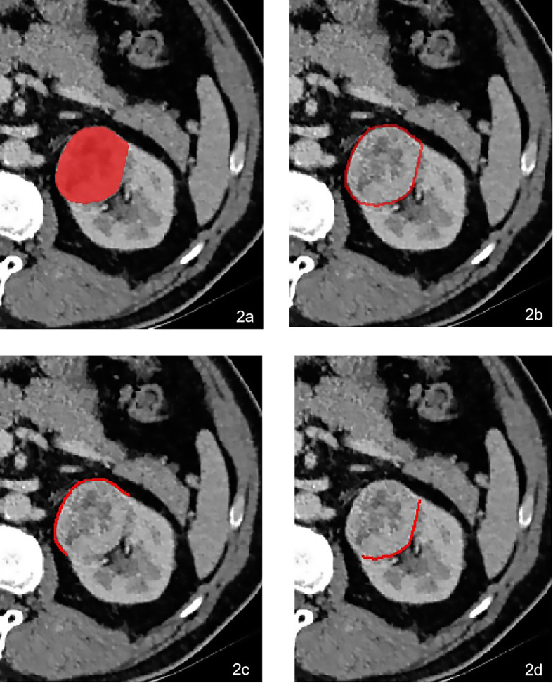 Figure 2