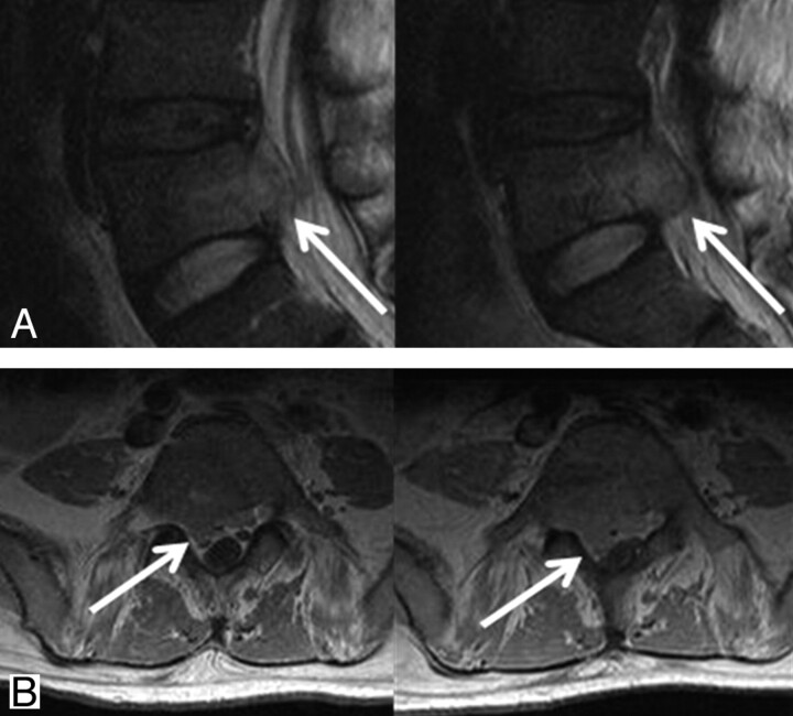 Fig 4.