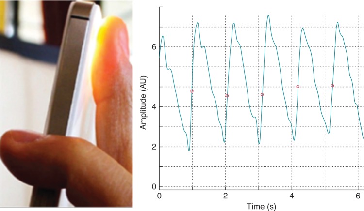 Figure 1