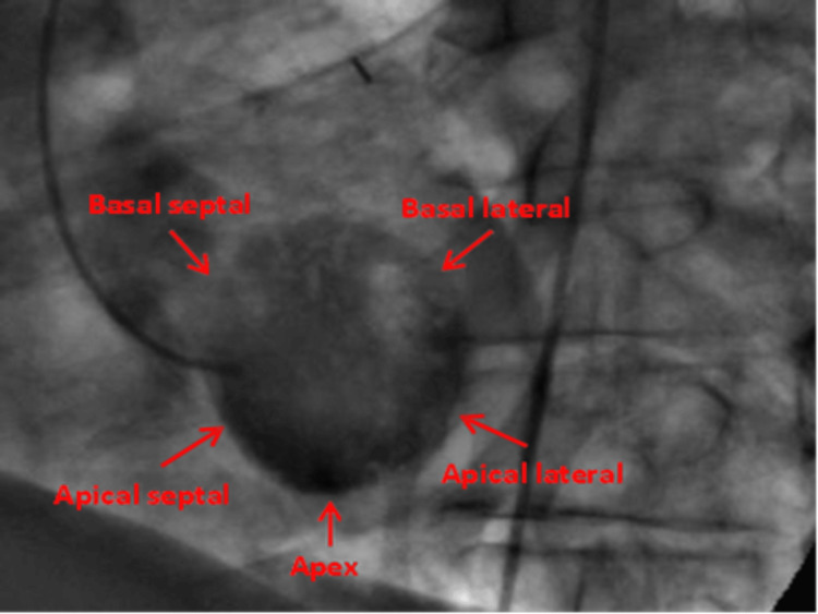 Figure 10