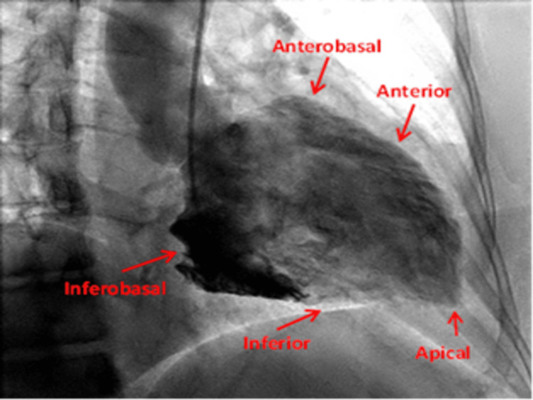 Figure 9