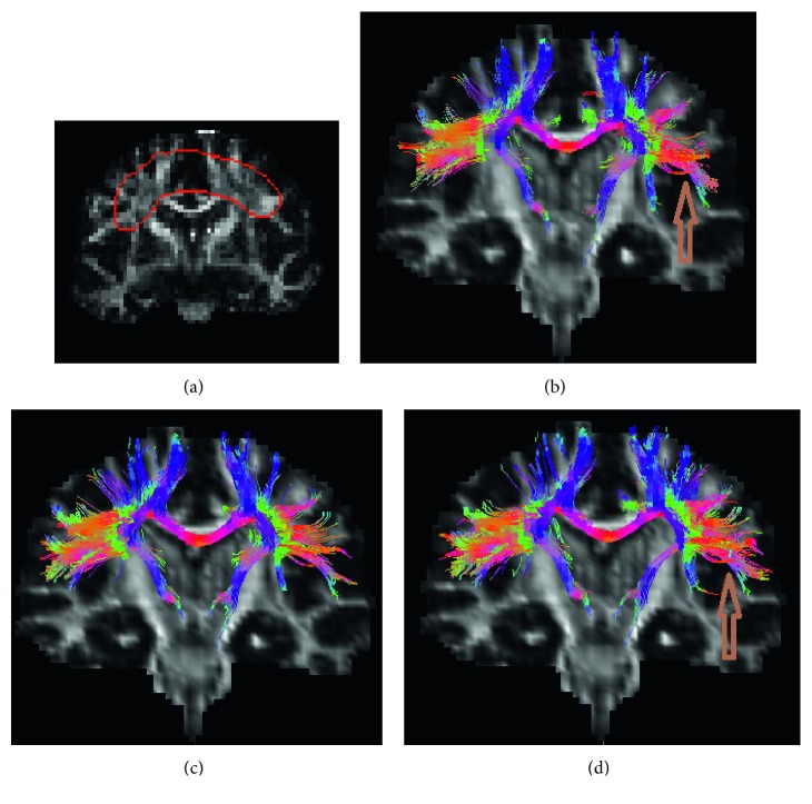 Figure 11