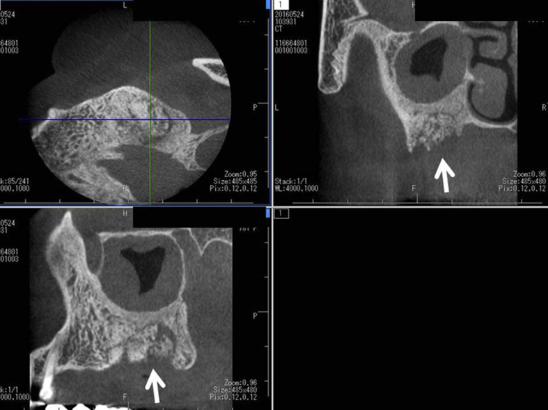 Fig. 3