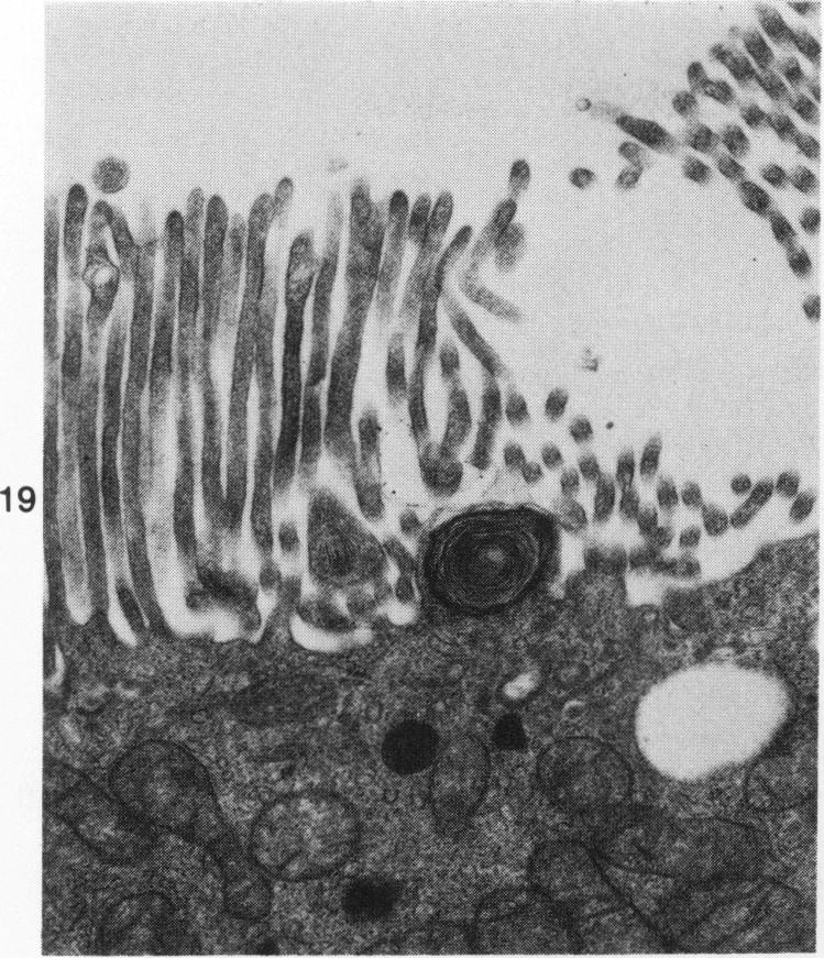 Figure 19