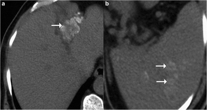 Fig. 11